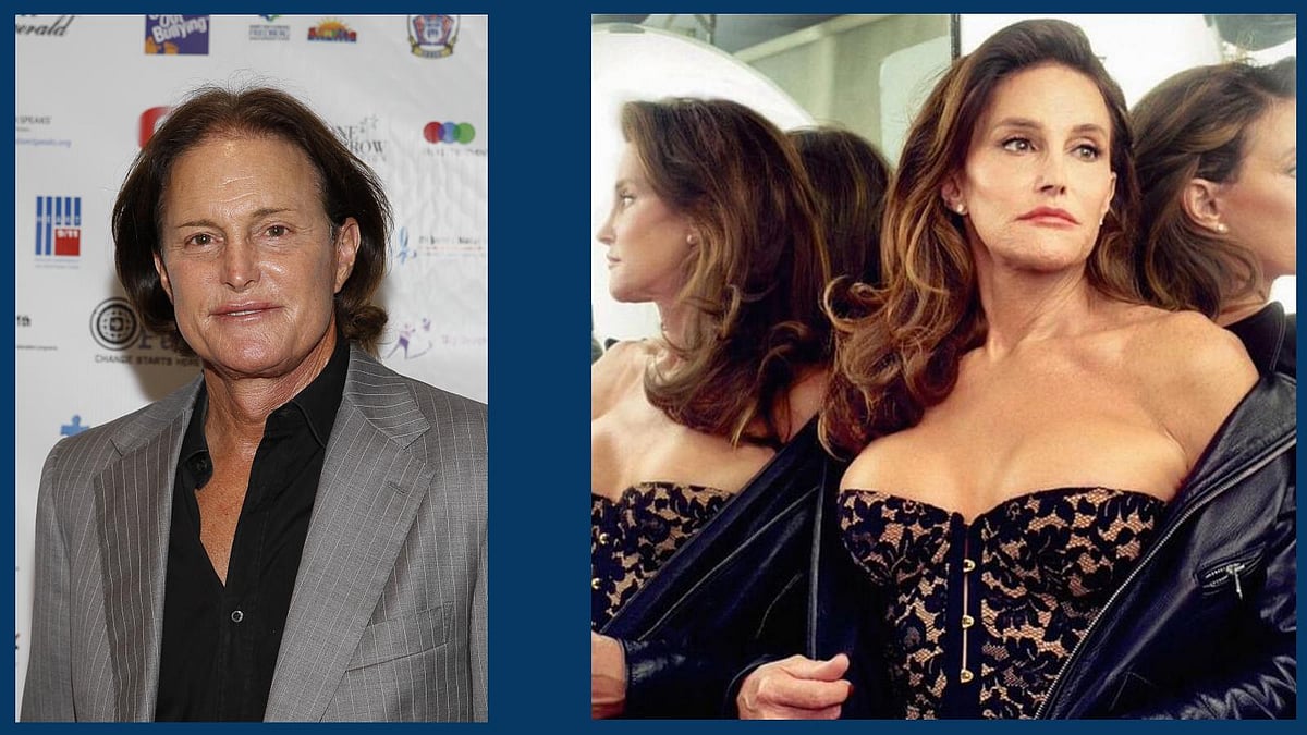 Caitlyn Jenner: Effects of Sex Change Surgery You Didn’t Know